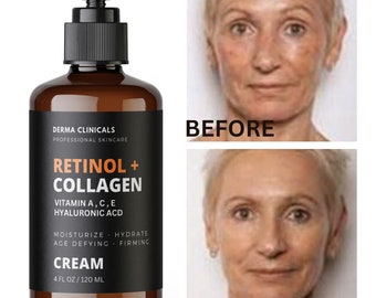 Retinol + Collagen, Hyaluronic Acid, Vitamin C Anti-Aging Wrinkle Serum Cream - 4oz