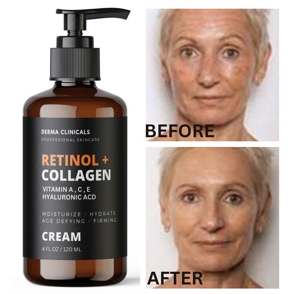 Retinol + Collagen, Hyaluronic Acid, Vitamin C Anti-Aging Wrinkle Serum Cream - 4oz