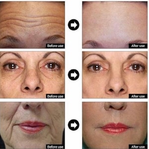 Matrixyl 3000, Argireline, Hyaluronic Acid, Wrinkle Remover serum, Anti Aging, Face Serum 4oz image 3
