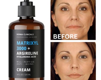 Matrixyl 3000, Argireline, Hyaluronic Acid Peptide Anti-Aging serum Wrinkle CREAM - 4oz