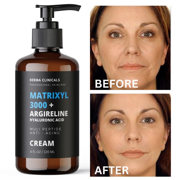 Matrixyl 3000, Argireline, Hyaluronic Acid Peptide Anti-Aging serum Wrinkle CREAM - 4oz