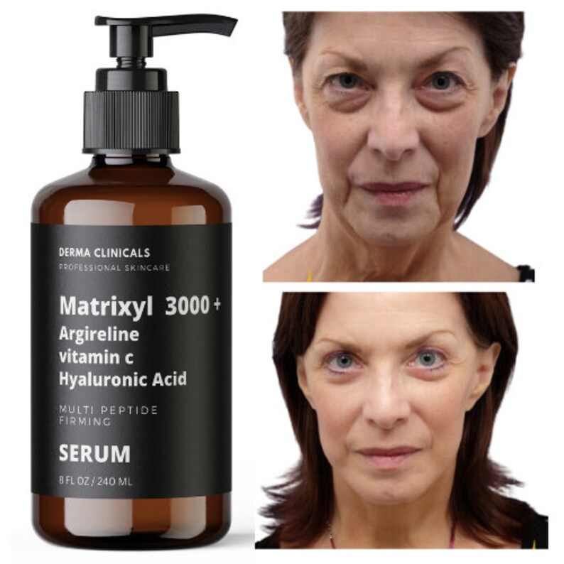 Matrixyl 3000, Argireline Vitamin C Hyaluronic Acid Peptide BOTOX Wrinkle SERUM Etsy