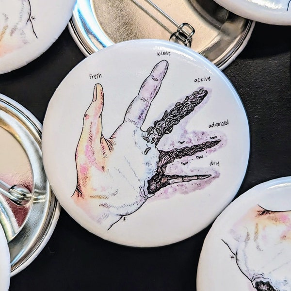 Stages of Decay Hand Pin Button: Forensic Science Gift