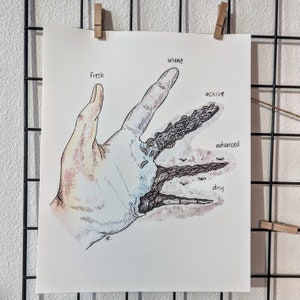 Stages of Decay Hand | Art Print by Skye Rain Art | Forensic Science | Pathology | Autopsy | Decomposition | Death | Canvas