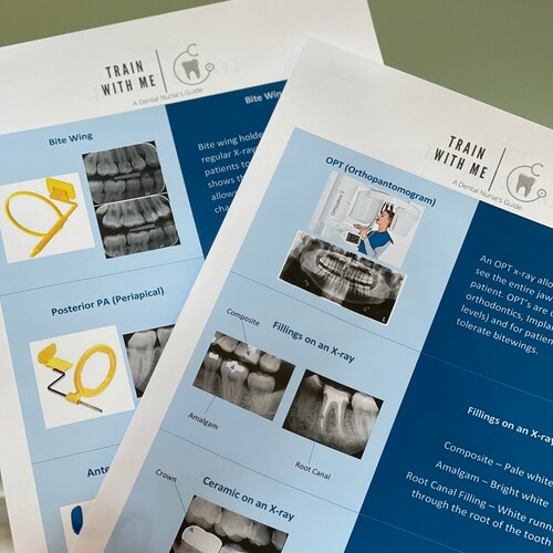 A Guide on Understanding Dental Xrays Etsy UK