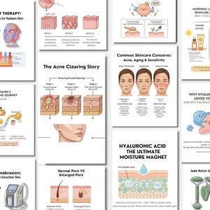 Puede incluir: Una colección de infografías educativas sobre el cuidado de la piel. Los temas incluyen terapia de luz LED, vitamina C, tratamiento del acné, rutinas de mañana y noche, ácido hialurónico y microdermoabrasión. Las imágenes presentan diagramas y texto.