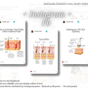 Puede incluir: Imagen que muestra tres publicaciones estilo Instagram con contenido educativo. Las publicaciones cubren temas como la retenci&oacute;n de pesta&ntilde;as, el desarrollo del acn&eacute; y los tipos de piel. El texto incluye "YouDecode" y "Radiofrequency (RF) Skin Tightening".