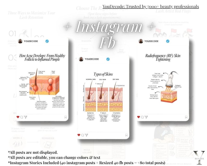 Puede incluir: Imagen que muestra tres publicaciones estilo Instagram con contenido educativo. Las publicaciones cubren temas como la retenci&oacute;n de pesta&ntilde;as, el desarrollo del acn&eacute; y los tipos de piel. El texto incluye "YouDecode" y "Radiofrequency (RF) Skin Tightening".