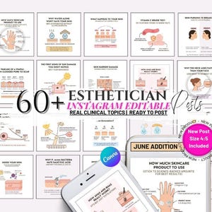 Könnte beinhalten: Eine Sammlung von 60+ Instagram-Posts für Kosmetikerinnen mit realen klinischen Themen. Die Beiträge werden auf weißem Hintergrund mit rosa und schwarzem Text dargestellt. Ein Smartphone zeigt einen Beitrag zur Verwendung von Hautpflegeprodukten.