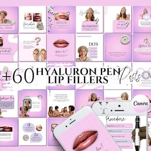 Lip Filler Flyer Hyaluron Pen Filler Flyer Lip Filler Post Instagram Hyaluron Pen Template Needleless Lip Filler Hyaluronic Acid SocialMedia