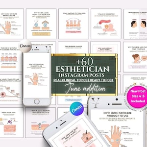 May include: A set of Instagram posts for estheticians, offering skincare advice and information. The image shows several smartphone mockups displaying educational graphics on topics such as skincare product use and skin barrier damage. The posts are ready to use.