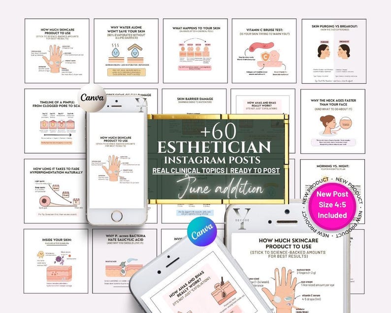 May include: A set of Instagram posts for estheticians, offering skincare advice and information. The image shows several smartphone mockups displaying educational graphics on topics such as skincare product use and skin barrier damage. The posts are ready to use.