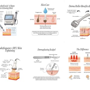 Puede incluir: Una infograf&iacute;a que detalla tratamientos para el cuidado de la piel. Incluye informaci&oacute;n sobre HydraFacial, cuidado de la piel, Derma Roller, tensado de la piel por radiofrecuencia, Dermaplaning y una comparaci&oacute;n de resurfacing con l&aacute;ser y microneedling.