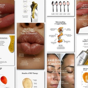 Könnte beinhalten: Eine Collage von Bildern zu kosmetischen Eingriffen, darunter Lippenfüller, Neurotoxine, Microneedling und PRP-Therapie. Die Bilder enthalten Texte wie "Lip Filler Goals", "How Long Do Lip Fillers Take To Dissolve?" und "Ideal Botox Candidate."