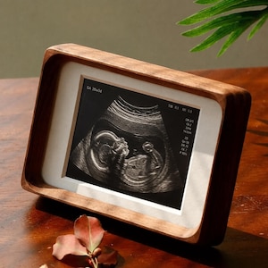 May include: A wooden picture frame with a white border holds a grayscale ultrasound image. The image shows a baby in the womb. Text on the image reads "GA 20w3d" and other technical data.