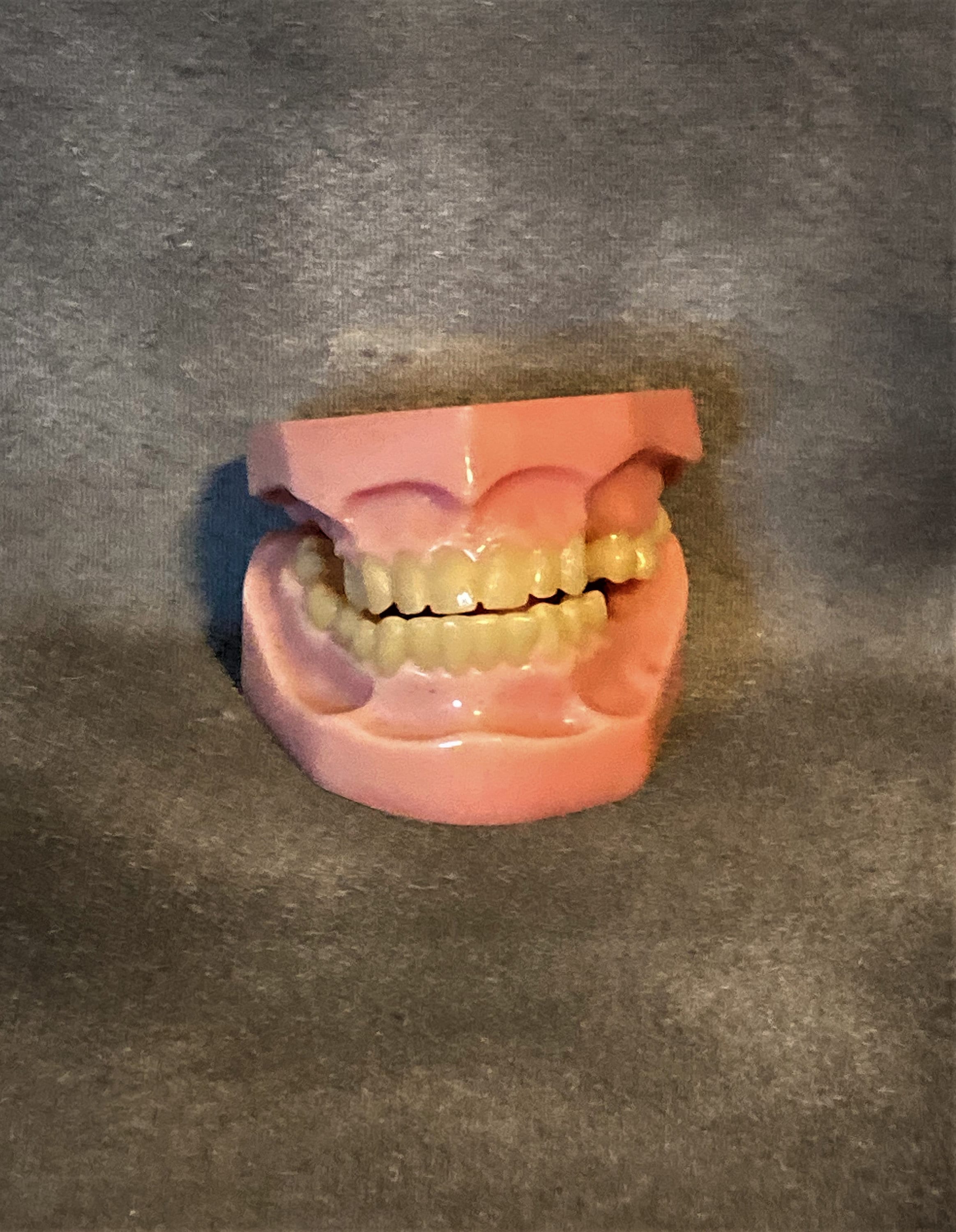 Plastic Dental Orthodontic Model Etsy