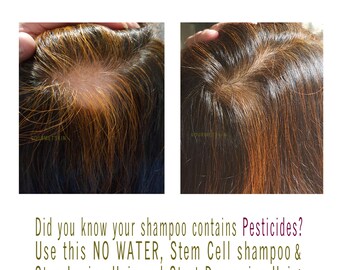 Stem Cell Hair Growth Shampoo and Conditioner Set