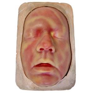 3D Silicone Face for Injectors Surgery, Learning Practice Tool for Training Medical Students, filler training, Cosmetic Injector