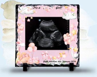 Baby scan print picture frame baby shower gift keepsake pink baby girl