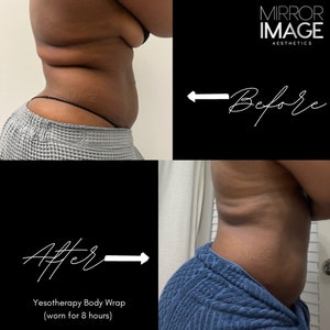 Yesotherapy Body Wraps Slimming Body Wrap Fat Reduction Body Wrap Wholesale Body Wraps (INCLUDES 6 WRAPS per order-2 Pink, 2 Yellow, 2 Gray) bild 4