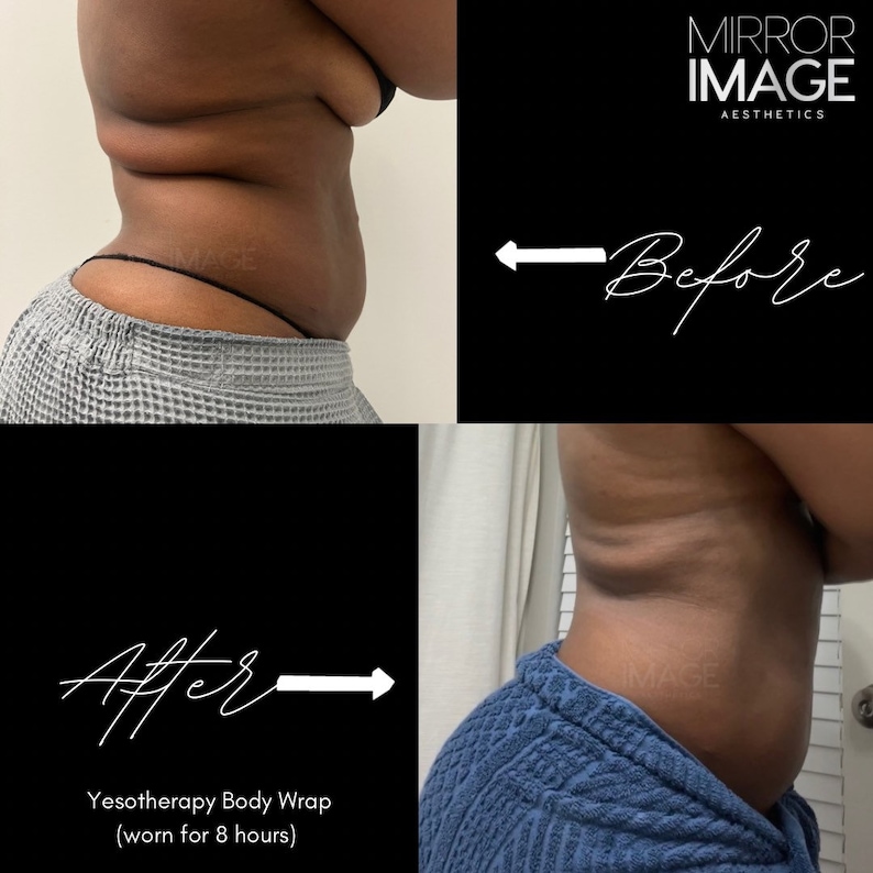 Yesotherapy Body Wraps Slimming Body Wrap Fat Reduction Body Wrap Wholesale Body Wraps (INCLUDES 6 WRAPS per order-2 Pink, 2 Yellow, 2 Gray) bild 4