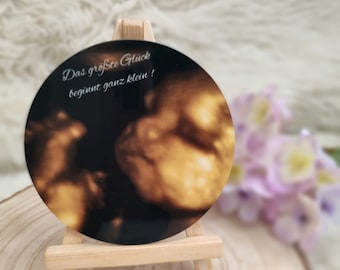 Ultrasound image for setting up, personalized, reminder, picture frame, baby scan