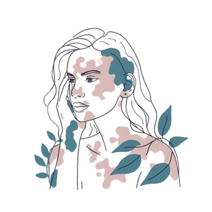 May include: Line drawing of a person with vitiligo, their skin is depicted with brown and blue patches. The person has long wavy hair and is wearing a simple top. There are stylized leaves behind the person.