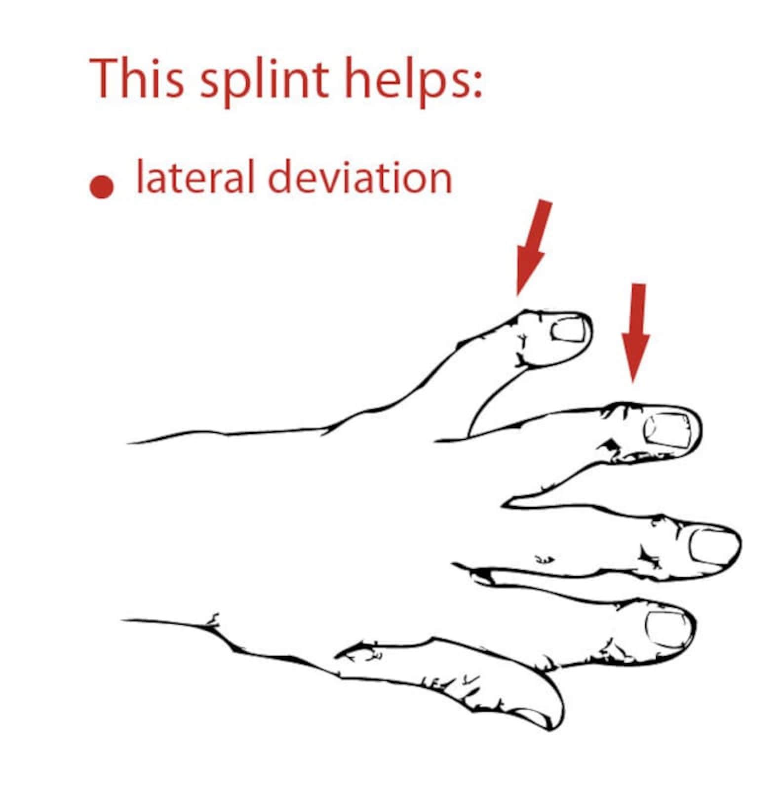 EDS Finger Splint Sterling Silver for Both Joints Etsy