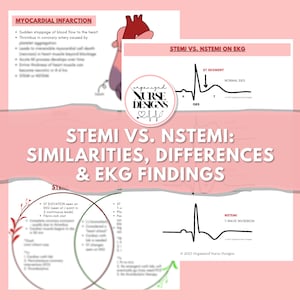 Cardiac Nursing School Study Guide STEMI vs. NSTEMI | Nursing School Notes Bundle | EKG & Dysrhythmias | Nursing Student