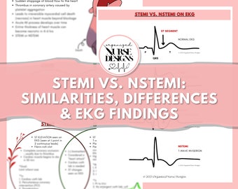 Cardiac STEMI vs NSTEMI Nursing Study Guide: EKG Interpretation (Digital Download)