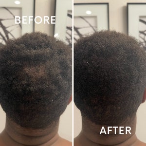 Hair Growth Oil and Butter for Thinning Hair - Regain Thickness & Volume