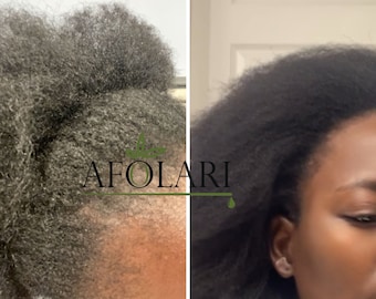 Organisk hårväxtolja | Naturlig hårbottenbehandling och hårförtjockande serum