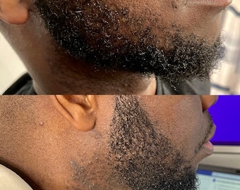 Beard Growth Oil for Men – Natural Sandalwood Beard Oil for Thicker, Fuller Beard | Organic Beard Serum for Patchy & Dry Beard
