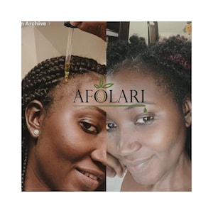 Fast-Acting Hair Growth Oil and Butter: Visible Results in Weeks, Not Months