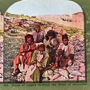 Grupo de Leprosos Sem Muros de Jerusalém Antigo Cartão Stereoview TJ9-V2