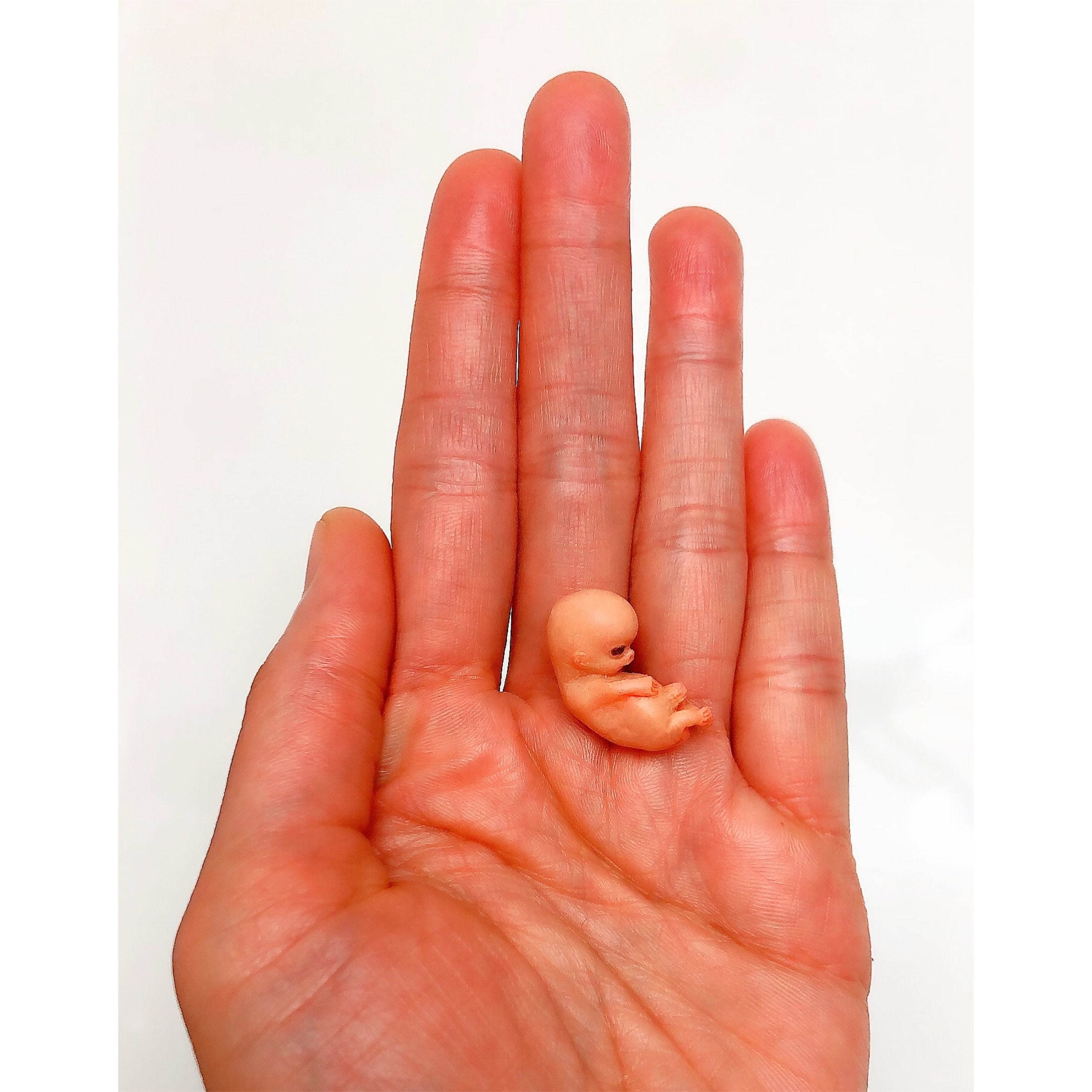 Real fetus