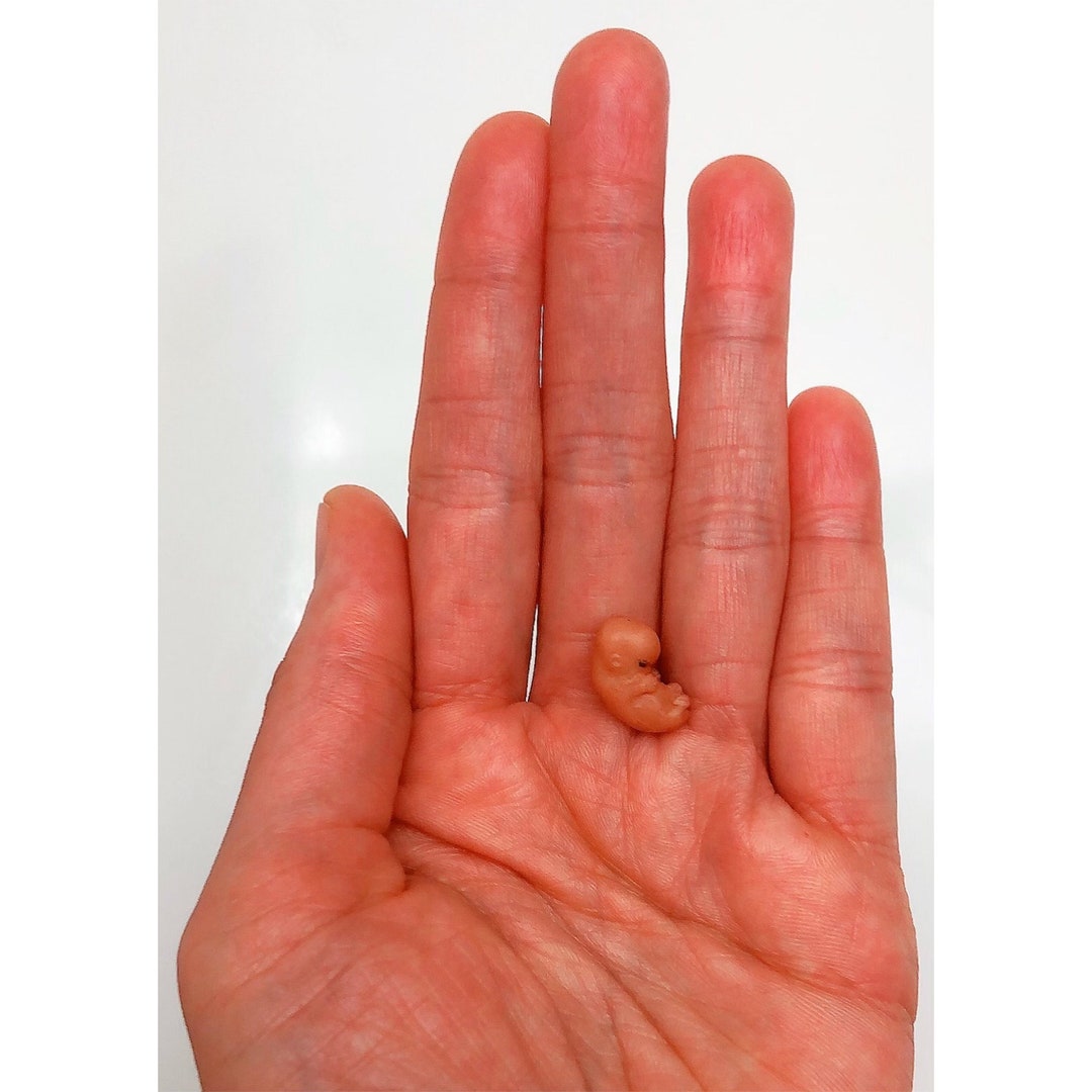MADE TO ORDER 8 Week Gestation Embryo, Stage of Fetal Development