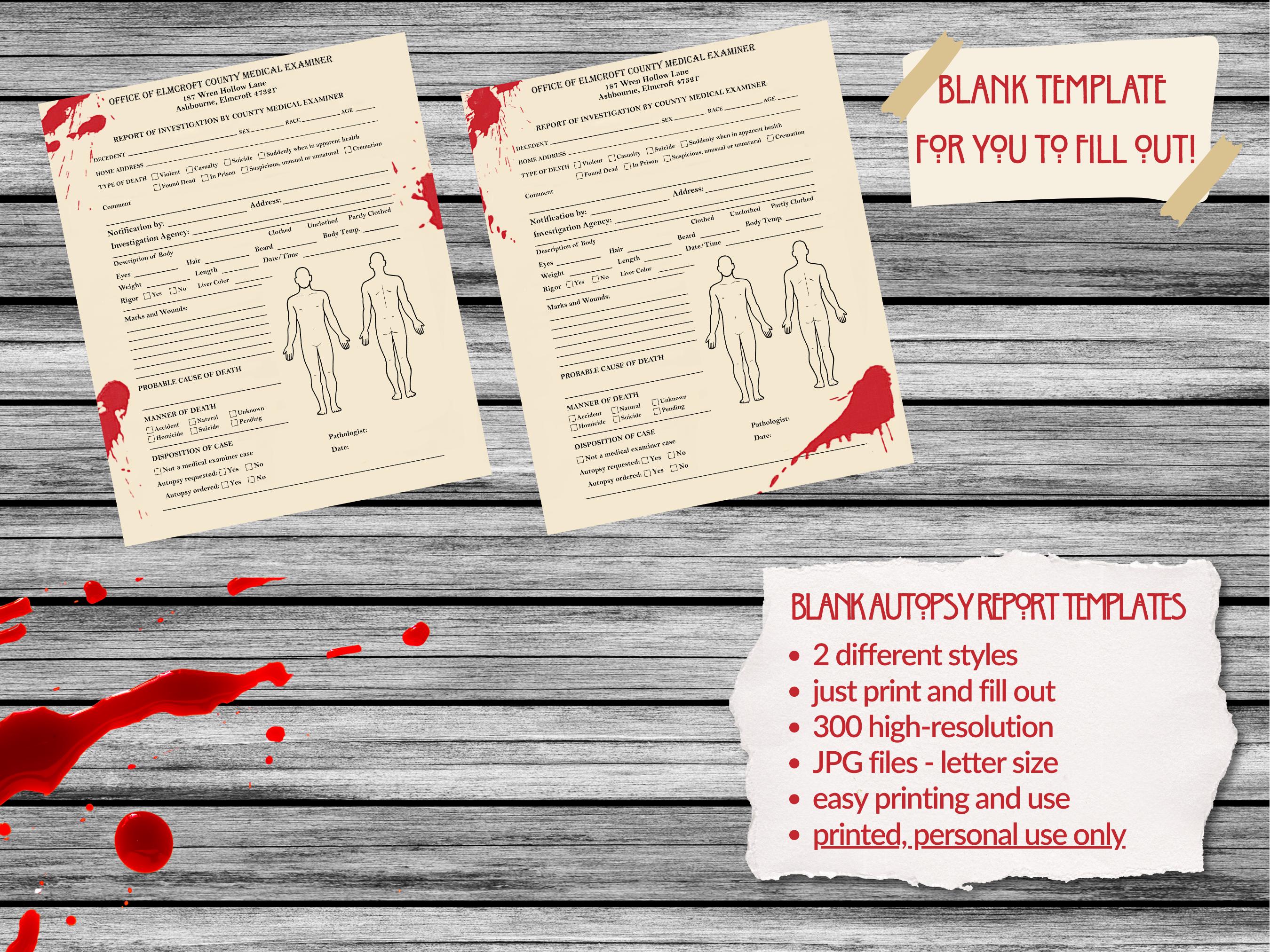Autopsy Report Printable, Autopsy Report Template, Murder Mystery Game ...