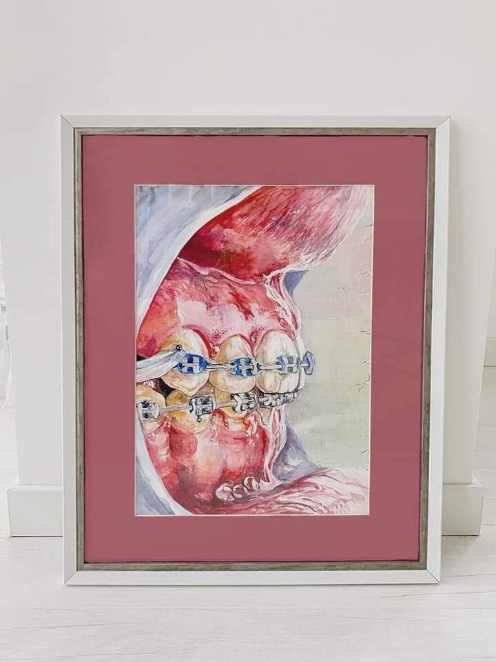 Painting braces Etsy