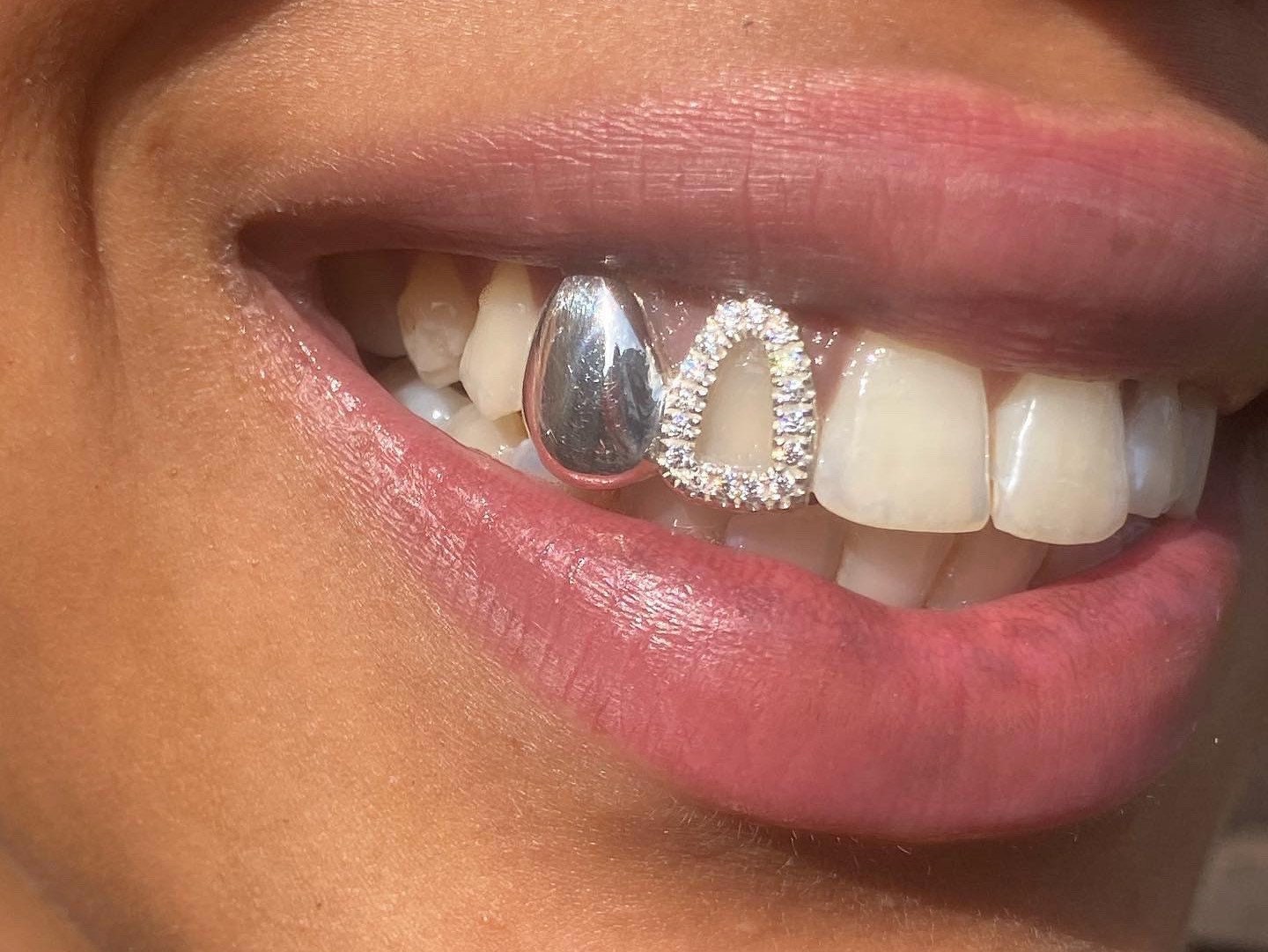Double Tooth Caps With Iced Diamond UK - Etsy Norway