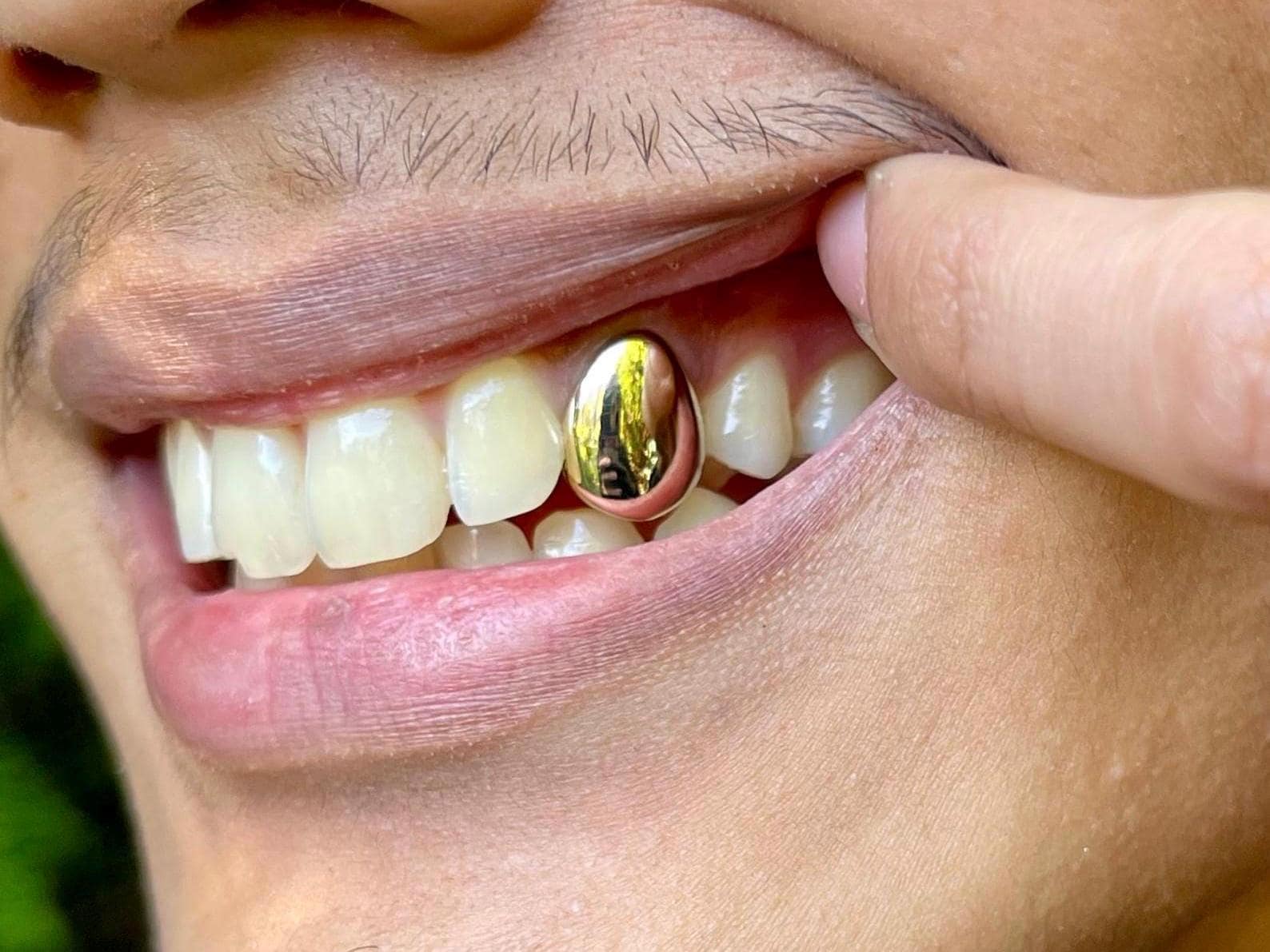 Gold teeth near me discount