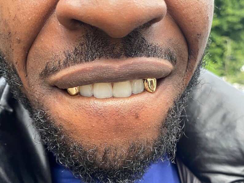 925 Sterling Silver Tooth Cap Grillz Etsy