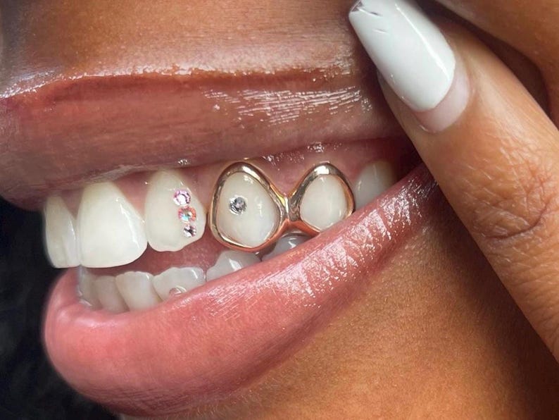 Puede incluir: Primer plano de la boca de una persona con una rejilla de oro con un dise&ntilde;o de doble s&iacute;mbolo de infinito. La rejilla tiene peque&ntilde;os diamantes de imitaci&oacute;n transparentes a cada lado. Los dientes de la persona son blancos y sus labios son rosados.