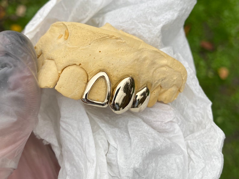 Single Dental Gold Tooth Cap Grillz Tarnish Free Etsy UK