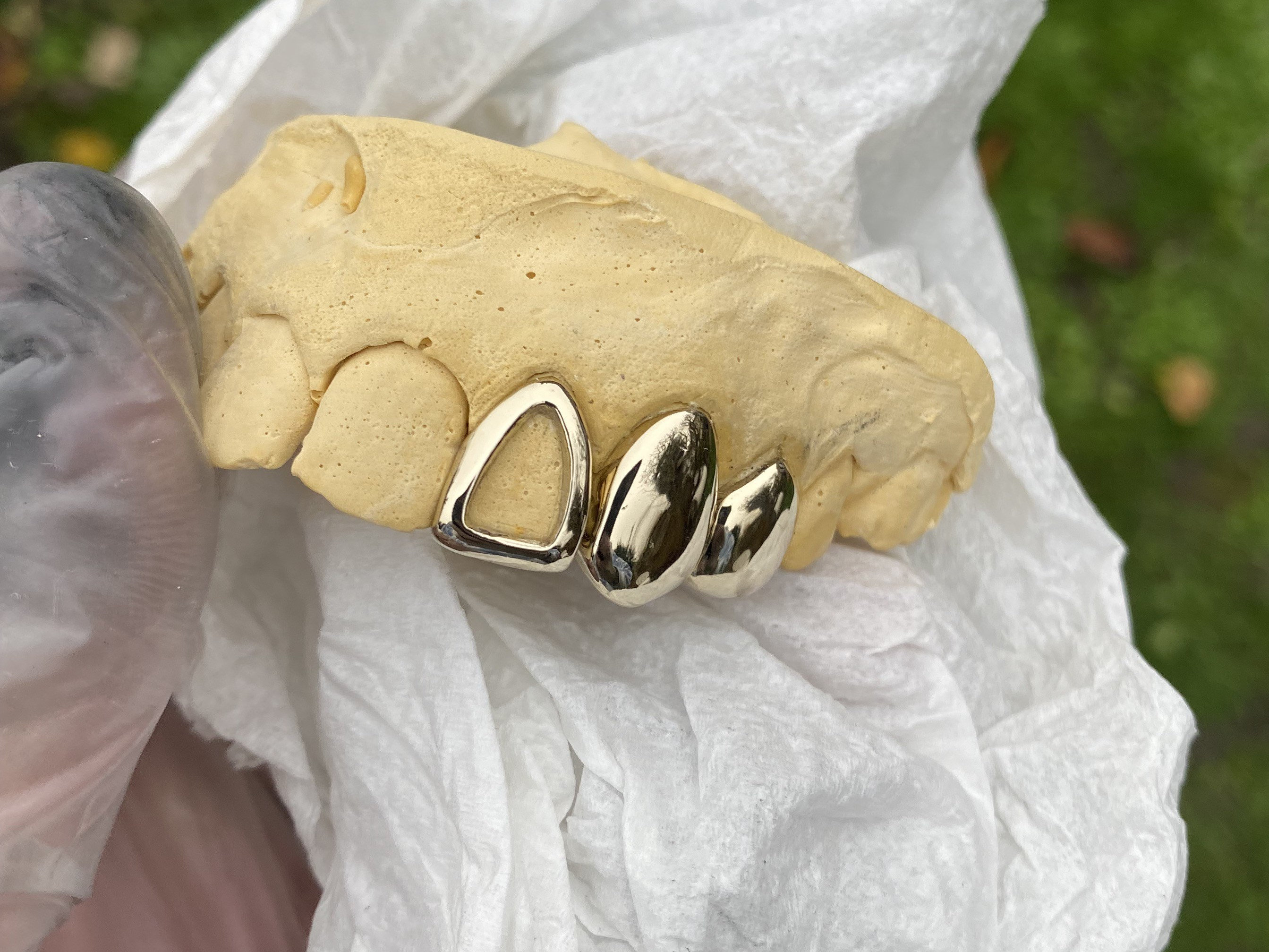 Single Dental Gold Tooth Cap Grillz Tarnish Free Etsy UK
