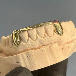 May include: Gold teeth grill with two fangs, shown on a dental mold.