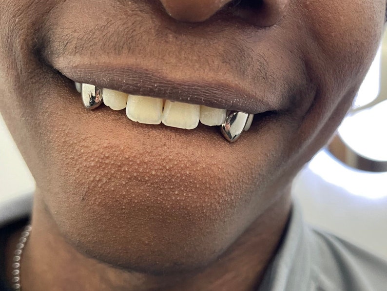 Sin deslustre Dental Gold Tooth Cap Grillz, a prueba de humo, envío a todo el Reino Unido imagen 2