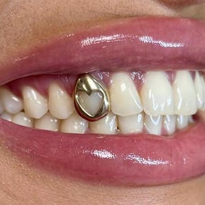 Grelhas de dente de janela de coração: boné de encaixe personalizado