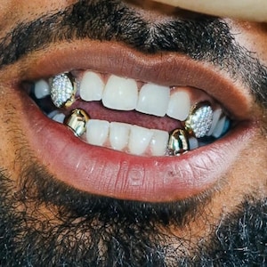 VVS Moissanite Tooth Cap Grillz, Diamond Teeth Worldwide Shipping!
