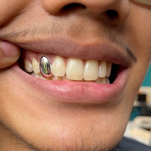 925 Sterling Silver Tooth Cap Grillz image 3